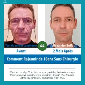 Annonce Produit anti rides pour toutes types