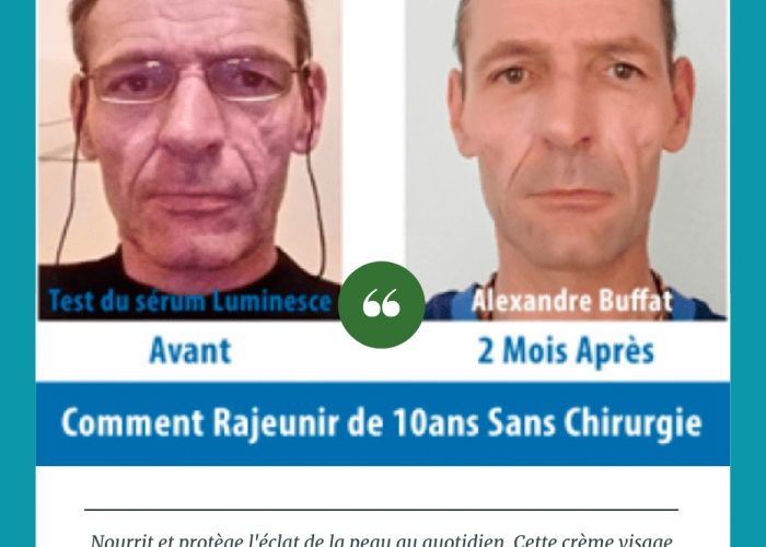 Image annonce: Produit anti rides pour toutes types