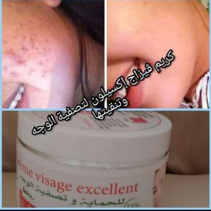 Annonce تصفية الوجه.الكلف.النمش