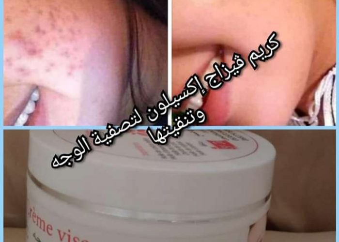 Image annonce: تصفية الوجه.الكلف.النمش