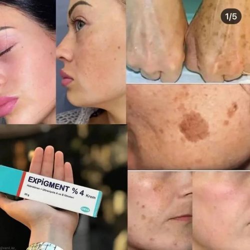 Annonce: Crême expigment 4%